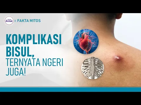 Jangan Sepelekan Bisul, Komplikasinya Dapat Membahayakan!