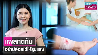 แผลกดทับเกิดจากอะไรบ้าง