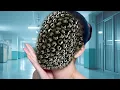 Download Lagu Wow ASMR Relaxing Treatment From Face | Dog Ticks and Maggots Removal | Animation 