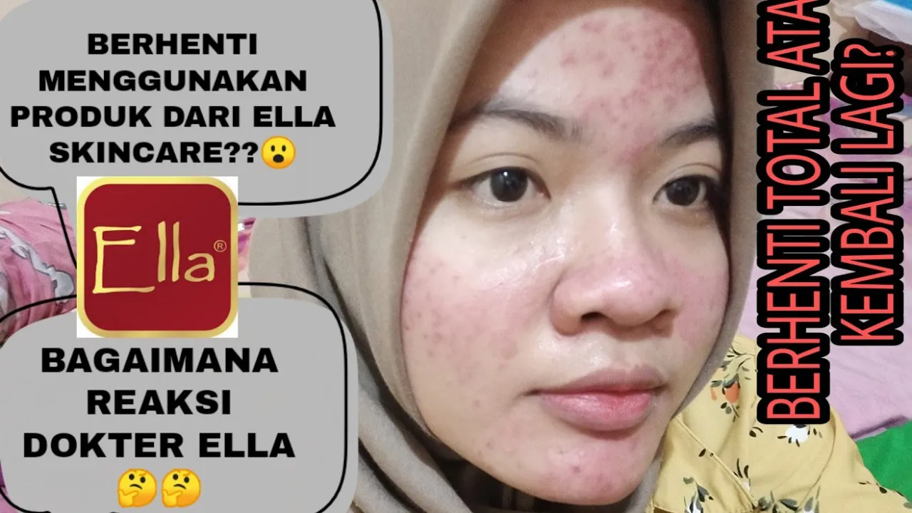 Bocorin harga Ella Skincare. 