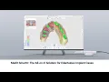 Medit SmartX The All-on-X Solution for Edentulous Implant Cases