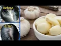 Download Lagu Cara Mengurangi Rambut Rontok Menggunakan Bawang Putih