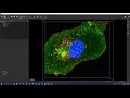 Intensity vs Object Based Coloc