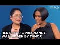 She Experienced an Ectopic Pregnancy Hidden by Tumor