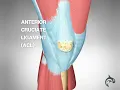 Understand Knee Ligament Injuries (ACL, PCL, MCL, LCL) - 3D animation