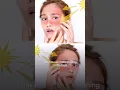 Download Lagu 🌞 Do you ever notice that your face is darker than the rest of your body? 🤔 || Dr Jushya Sarin ||