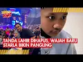 Lagu Starla Rhea Idola Hilangkan Tanda Lahir, Virgoun Tunjukkan Penampilan Barunya ke Publik