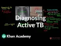 Diagnosing active TB Infectious diseases NCLEX-RN Khan Academy