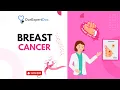 What is Breast Cancer How can you sign up for a consultation https ourexpertdoc com