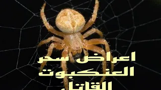 أعراض سحر العنكبوت 