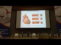 IV Universal Definition of Myocardial Infarction - Joseph S Alpert