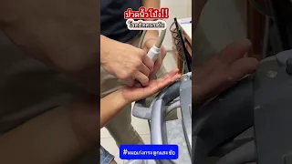  ทำไมนิ้วโป้งถึงงอไม่ลงได้บ้าง 