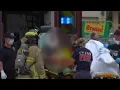 11-year-old shot in face in Cypress deputies say