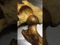 Dr Pratheepa s tutorial - Hip joint