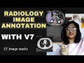 Annotating Radiology Images with V7 An Annotator s Guide