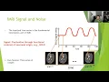 fMRI Denoising Techniques