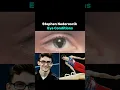 Stephen Nedoroscik s Eye Condition - Is it Serious