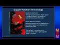 MSWM Radar Secrets - Velocity