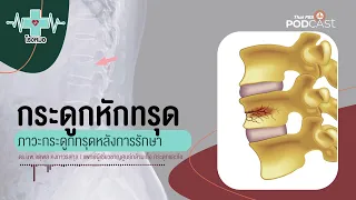 การใส่เฝือกหลังจากหักกระดูกแล้ว ทำไมบางครั้งกระดูกยังทรุดลงได้