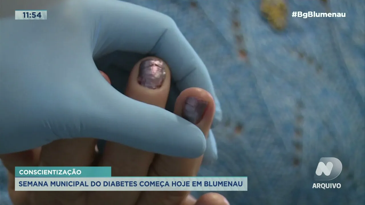 Semana municipal do diabetes começa dia 08 11 em Blumenau