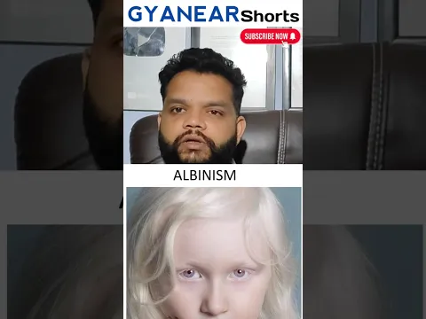 Albinus Skin Disease Explained In Short #skincare #dermatology #allergy #health