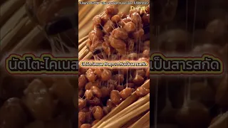  หินปูนในหลอดเลือดแดงเกิดจากอะไร และจะลดความเสี่ยงได้อย่างไร 