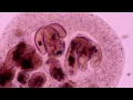 A dramatic description of amoeba lifestyle