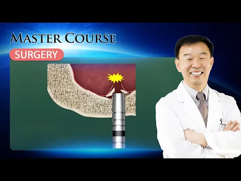 Download MP3 [Master Course - SURGERY] Intra operative Complications during Sinus Elevation