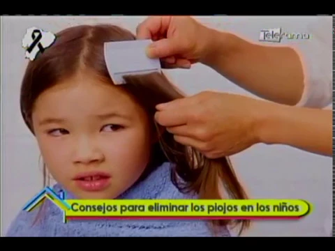 Consejos para eliminar los piojos en los niños