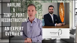 Revealed: "The Hairline Secret" For Natural Temples