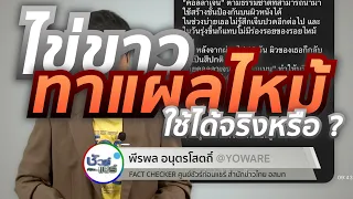 ควรทำอย่างไรเมื่อเกิดแผลไหม้จากน้ำร้อนหรือไฟ