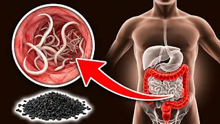 3 Seeds That FORCE Intestinal Worms Out of Your Body 💥🤯