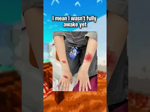 Minecraft Is A BUG