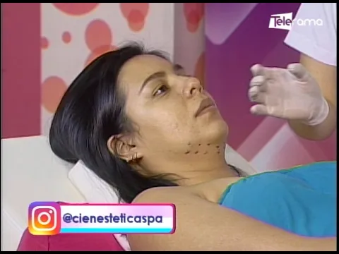 Lipoenzimática en papada