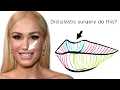 What Happened to Gwen Stefani s Face Newport Beach Plastic Surgeon explains