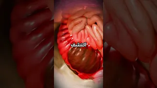 عندما يصبح البراز خطر ا قصة مذهلة تيك توك قصص 