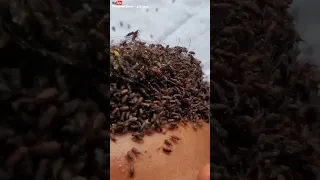 قمل الرأس اتحداك تكمل الفيديو بدون ماتحك شعرك 