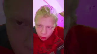استبلات  دندنها