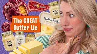 Are Butter, Beef Tallow & Coconut Oil: Are Saturated Fats Actually Healthier than Seed Oils? / Pt.2
