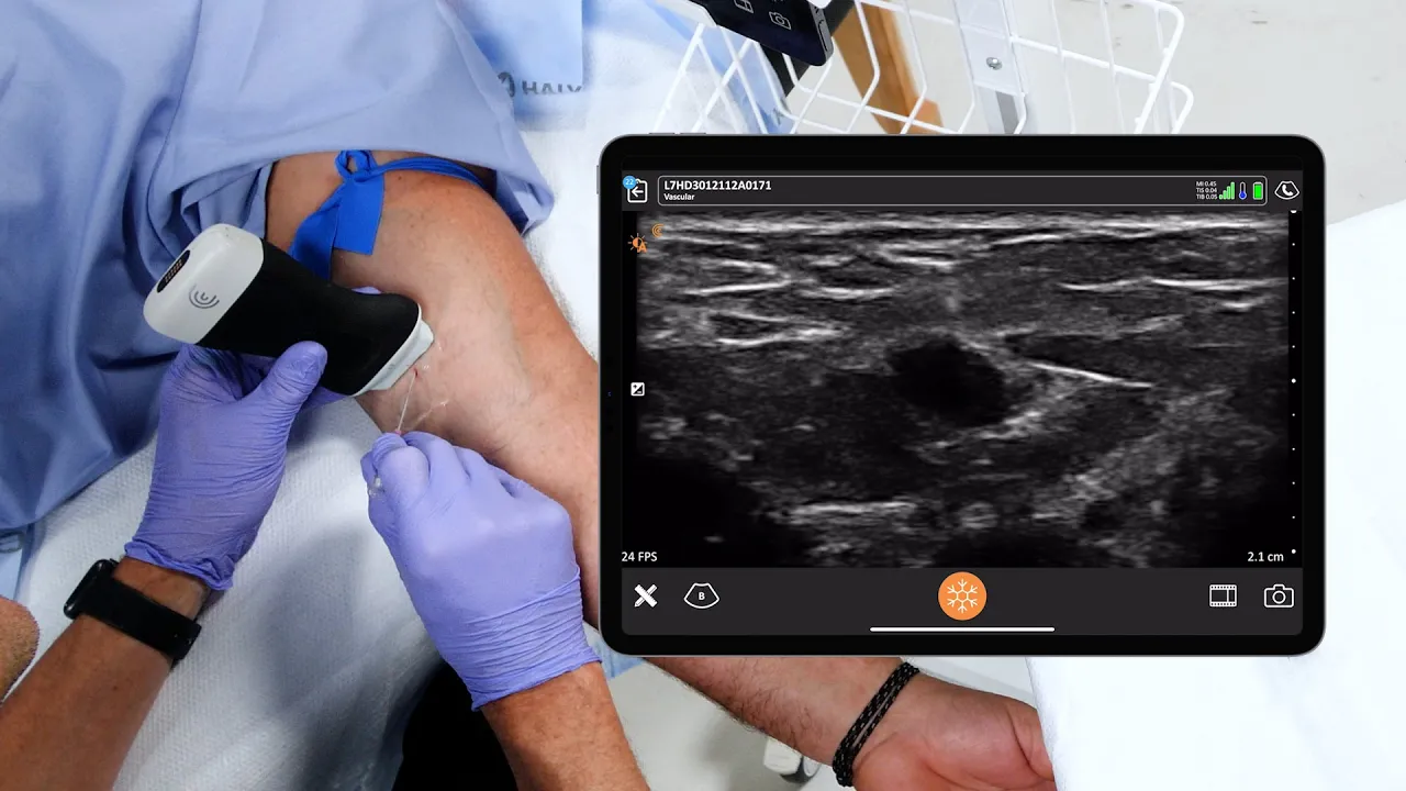 Peripheral Venous Catheter Placement