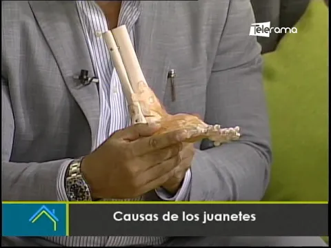 Causas de los juanetes