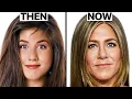 Jennifer Aniston s New Look Plastic Surgery Analysis