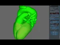 fixing self-intersections of surfaces