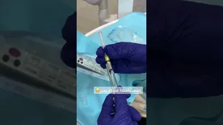 أصعب لحظة عن المريض هي الأبرة دكتور اسنان دكتور طبيب 