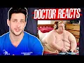The Harsh Reality Of Being 800 Pounds Doctor Reacts