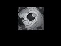 Download Lagu i’m not angry anymore, well sometimes i am (slowed + reverb)