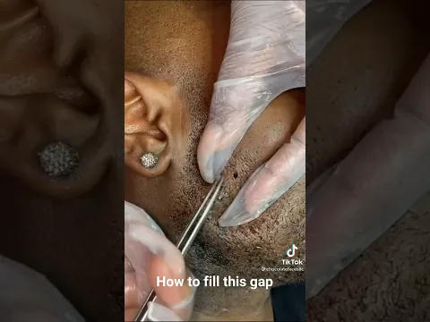 How to fill this gap