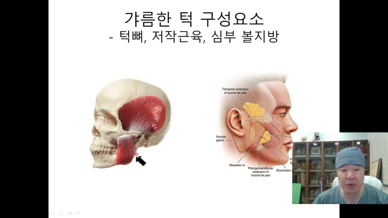 턱, 심부볼 지방제거로 갸름해질수 있을까?