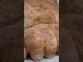 Download Lagu This Woman Found Maggots in Between Her Toes...🪳🦶 | Dr. Pimple Popper | TLC