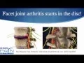 Facet Syndrome Arthritis Explained by Mid Atlantic Pain Network